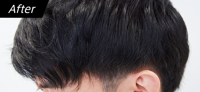イメージ画像 After