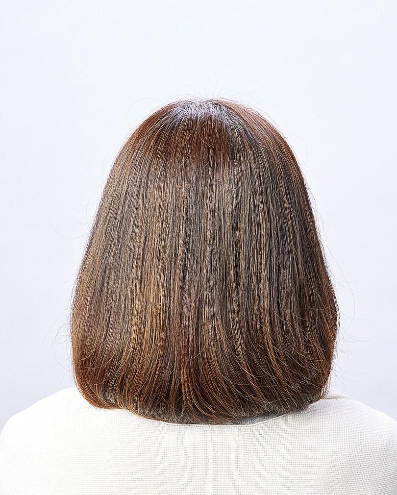 GBeのBefore写真